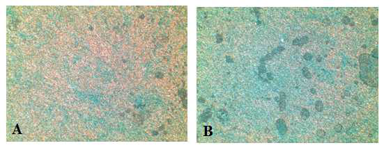 배양액 차이에 따른 분화의 차이 (alcian blue staining, A: Alpha MEM B: B-ALITM Bronchial Air-Liquid Interface Medium BulletKit, Lonza, swirzerland). 분화배지에서 goblet cells 에서의 mucin이 분화배지에서 더 잘 관찰되는 것을 확인함