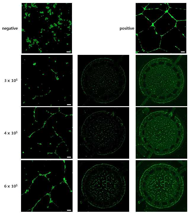 혈관화 유도를 위한 세포 조건 실험