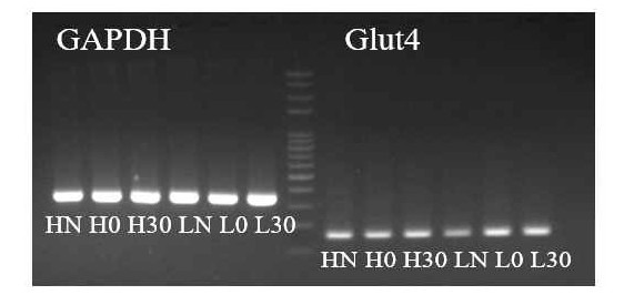 RT-PCR로 확인한 각 포도당 조건에서 원적외선 방사 섬유 처리 시 glut4 발현 변화 HN:High glucose, H0:High glucose, 0% FIR H30: High glucose 30% FIR LN: Low glucose, L0: Low glucose, 0% FIR L30: Low glucose, 30% FIR