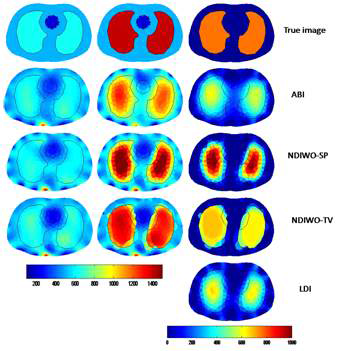 Numerical results for thorax imaging. Top row contains true resistivity and second, third and fourth row are the estimated resistivity using absolute (ABI), nonlinear difference imaging with Otsu method employing smoothness prior (NDIWO-SP) and TV regularization (NDIWO-TV) and linear difference imaging (LDI)