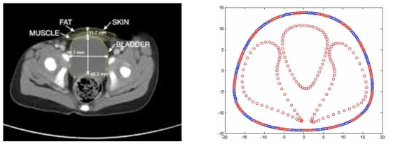 mathematical model for bladder based on CT image