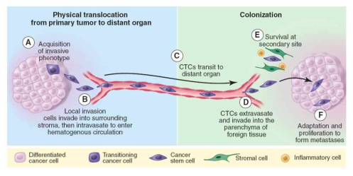 The metastasis cascade. CTC, circulating tumor cell (Chaffer and Weinberg, Science 2011)