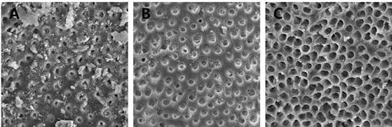 A. Manual needle irrigation, B. EndoActivator C. CK file군의 대표적인 SEM 사진