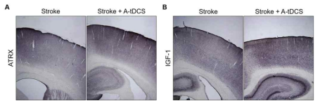 운동피질 영역에서 ATRX 및 IGF-1의 발현