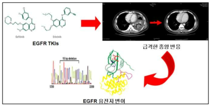 폐암 환자의 표적치료에 대한 내성의 예