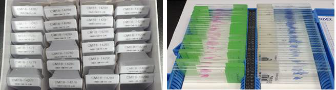 만든 파라핀 블록과 H&E stain, Masson-trichrome stain 슬라이드