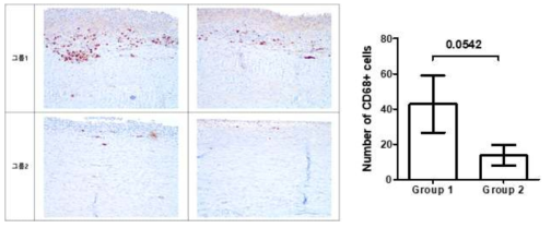 CD68 염색을 통한 Macrophage 수 측정