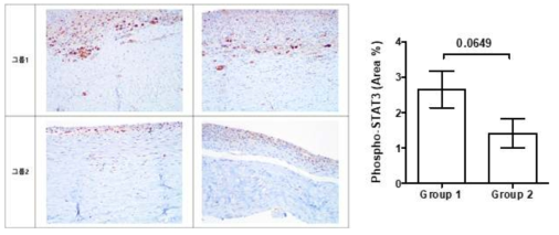 Phospho-STAT3 염색을 통한 염증 정도 비교