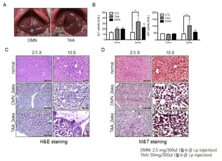 간독성 모델을 만들기 위한 TAA와 DMN 실험 결과 A. 약물에 의해 손상된 간모습 B. 약물 주입후 1,2주후 혈액의 ALT, AST 수치 C. H&E 염색 결과 D. Masson’ trichrome 염색 결과