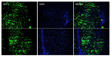 GFP 형질전환 돼지에서 얻어낸 BM-MSC가 주입된 돼지 간에서의 GFP발현 이미지