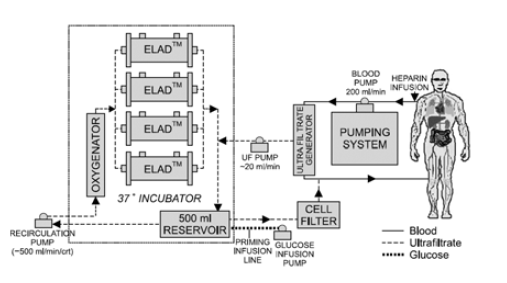 Extracorporeal Liver Assist Device (ELAD)의 모식도