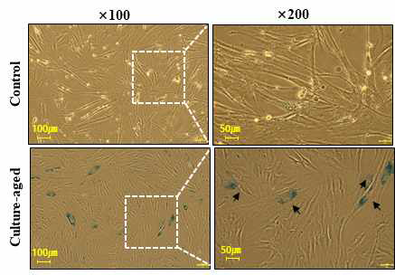 노화된 줄기세포 특성 확인