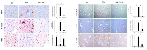 PKCδ peptide inhibitor attenuates the progression of CCl4-induced liver fibrosis in mice. Representative liver tissue sections from ND, CCl4, and V1-1 peptide-treated CCl4 mice were subjected to immunohistochemical analysis for F4/80, phosphorylated PKCδ, and SIRT1