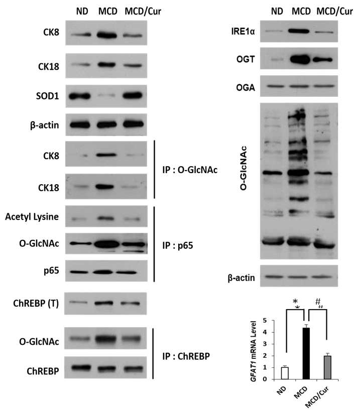 O-GlcNAcylation and the proteins associated with HBP. Data are representative of three independent experiments. Relative expression levels of the protein associated with HBP were determined by qRT-PCR analysis. Differential levels of XBP1s and GFAT1 mRNAs are shown as fold increase. The left panel shows that P65 was immunoprecipitated with anti-P65antibody and the immunoblotted against acetyl lysineand O-GlcNAc, separately. Similarly, on the right panel, hepatic expression levels of ChREBP were measured, and ChREBP was also immunoprecipitated and then immunoblotted against O-GlcNAc