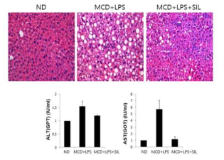 Effect of silibinin treatment on liver disease. (A) Hematoxylin-Eosin (H&E) stained liver section analyzed in ND (n=5), MCD + LPS (n=7), MCD + LPS + silibinin(SIL) (n=7). Lipid droplets distribution was remarkable in ML group. In silibinin treatment group, liver tissue condition was recovered compared to ML group. (B) serum AST, ALT level values were analyzed