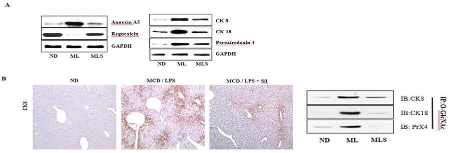 Validation of the differentially expressed protein. Liver tissue extracts were prepared from the mice fed ND, MCD/LPS, or MCD/LPS + silibinin. (A) The left panel shows the hepatic expression levels of annexin A5 and regucalcin, as determined by western blotting using equivalent amounts of total liver protein. The expression levels were normalized relative to GAPDH. The right panel shows the relative expression levels of CK8, CK18, and peroxiredoxin-4. Data represent three independent experiments. (B) Liver sections were subjected to immunohistochemical analysis using antibodies to CK8 and O-GlcNAc was immunoprecipitated with anti-O-GlcNAc antibody, and then immunoblotted against CK8, CK18, or peroxiredoxin-4, respectively