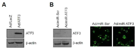 아데노바이러스 시스템을 이용한 ATF3 과발현 또는 발현억제