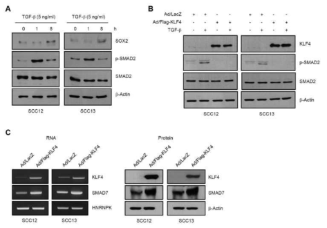 KLF4에 의한 SMAD7 발현 촉진 및 SMAD2 시그날 억제
