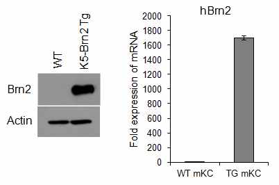K5-Brn2 Tg에서 Brn2의 발현