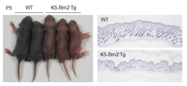 K5-Brn2 Tg의 피부