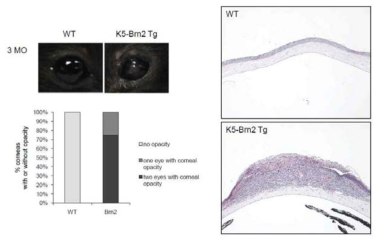 Brn2 과발현에 의한 각막 이상