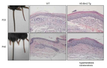 K5-Brn2 Tg의 꼬리 피부