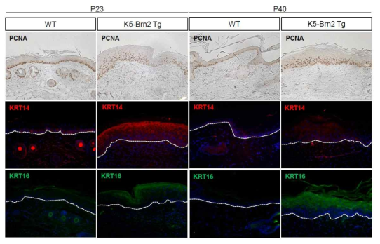 K5-Brn2 Tg 표피에서 각질형성세포의 분열 증가