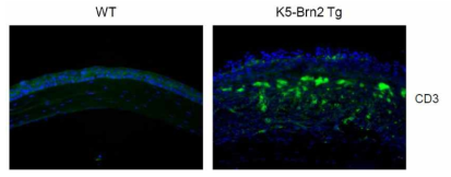 K5-Brn2 Tg에서 T cell 침윤 증가