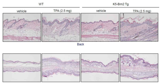 Brn2 과발현이 TPA에 의한 표피 두께 증가에 미치는 영향