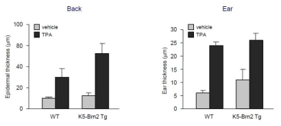 Brn2 과발현이 TPA에 의한 표피 두께 증가에 미치는 영향