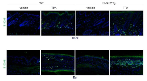 Brn2 과발현이 TPA에 의한 면역세포 침윤에 미치는 영향