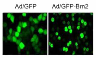 각질형성세포에서 아데노바이러스를 이용한 Brn2 과 발현