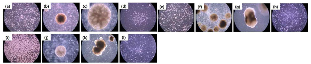 (a~d) Aa 0.105 nmol/cm2, 1×105 cell seeding 1, 12, 19, 19 days, (e~h) Aa 2.004 nmol/cm2, 1×105 cell seeding 1, 12, 32, 32 days, (i~l) DACH 1.249 nmol/cm2, 1×105 cell seeding 1, 12, 29, 29 days