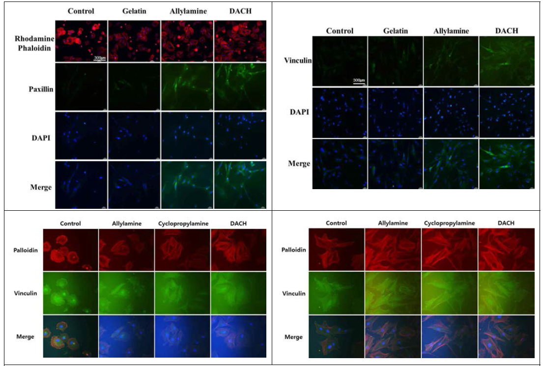 iPSCs-MSCs의 초기부착 단백질 Paxillin과 Vinculin 형광사진