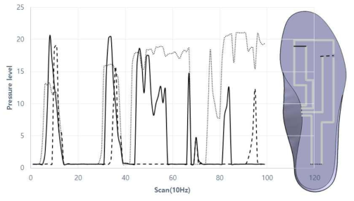 Foot pressure measurement