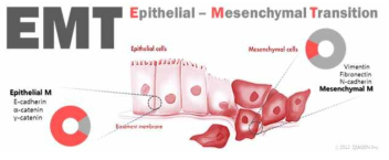 Epithelial-Mesenchymal Transition (EMT)