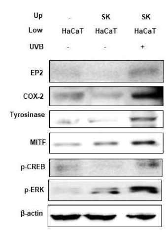 UVB 처리된 흑색종세포가 각질세포의 tyrosinase 발현에 미치는 영향