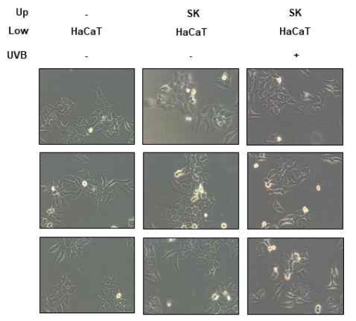 UVB 처리된 흑색종세포와 공동배양한 각질세포