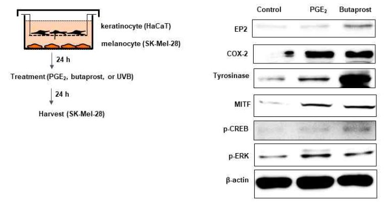 PGE2와 butaprost 처리된 각질세포가 흑색종세포의 tyrosinase 발현에 미치는 영향