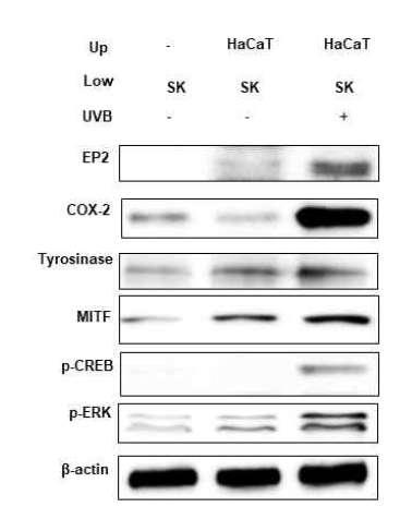 UVB 처리된 각질세포가 흑색종세포의 tyrosinase 발현에 미치는 영향