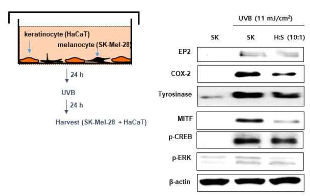 UVB 조사 후 각질세포와 공동배양한 흑색종세포의 tyrosinase 발현