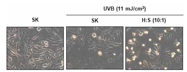 UVB 조사 후 각질세포와 흑색종세의 공동배양