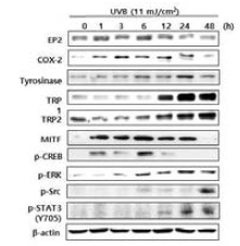 SK-Mel-28 세포주에서 UVB의 melanogenesis 관련 단백질 인자의 발현 및 신호전달효소 활성화 효과