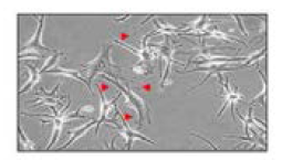 SK-Mel-28 세포주에서 UVB의 멜라닌 분비 효과