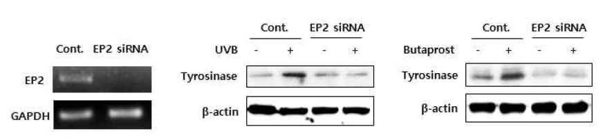 SK-Mel-28 세포주에서 EP2 siRNA에 의한 tyrosinase 단백질 발현 억제 효과