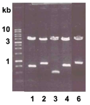 간흡충 담즙산 수송체 EST의 cDNA 확인, Lane 1. MRP1a, 2. MRP1b, 3. MRP3, 4. MRP7, 6. OATP