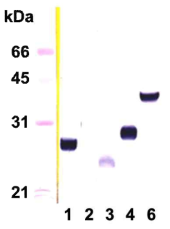 간흡충 담즙산 수송체의 단백질 발현 결과.1. MRP1a, 2. MRP1b, 3. MRP3, 4. MRP7, 6. OATP