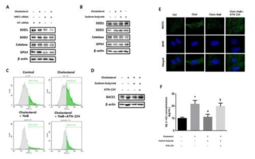 부티르산이 SOD1발현을 통해 고콜레스테롤에 의해 유도되는 활성산소종에 미치는 영향