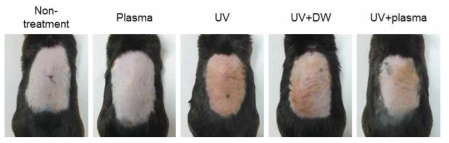 UV에 의해서 유도된 피부염증에 대한 액상플라즈마의 피부진정 효과