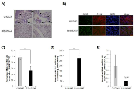 세포투과 HOXA9 융합단백질을 누드 마우스에 주사하여 암의 전이 억제를 확인. A) control 처리군과 세포투과 HOXA9 융합단백질 처리군 폐 조직의 H&E 염색, B) control 처리군과 세포투과 HOXA9 융합단백질 처리군의 폐 조직의 면역염색, C) qRT-PCR을 이용하여 폐 조직에서 SNAI2 발현확인, D) qRT-PCR을 이용하여 폐 조직에서 CDH1 발현확인, E) qRT-PCR을 이용하여 폐 조직에서 MMP9 발현확인